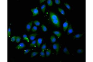 Immunofluorescence staining of A549 cells with ABIN7163123 at 1:200, counter-stained with DAPI. (ABCB4 抗体  (AA 530-693))