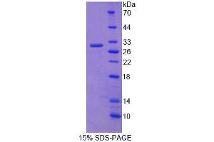 SDS-PAGE analysis of Mouse CHGB Protein. (CHGB 蛋白)