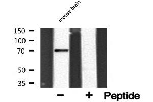 anti-Synaptotagmin Binding, Cytoplasmic RNA Interacting Protein (SYNCRIP) (Internal Region) antibody