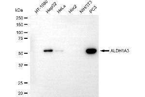 Western blotting analysis using ALDH1A3 antibody (ABIN7797558). (ALDH1A3 抗体)