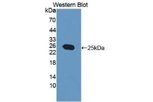Detection of Recombinant MGMT, Human using Polyclonal Antibody to O-6-Methylguanine DNA Methyltransferase (MGMT) (MGMT 抗体  (AA 1-207))
