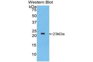 Western blot analysis of the recombinant protein. (IFNA2 抗体  (AA 24-188))