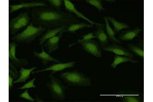 Immunofluorescence of purified MaxPab antibody to NUDT5 on HeLa cell.