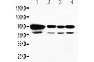 Anti-HSPA2 antibody, Western blotting Lane 1: Rat Testis Tissue Lysate Lane 2: A549 Cell Lysate Lane 3: MCF-7 Cell Lysate Lane 4: HELA Cell Lysate (HSPA2 抗体  (C-Term))