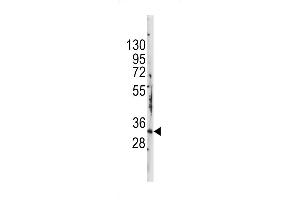 Western Blotting (WB) image for anti-Signal Transducing Adaptor Family Member 1 (STAP1) (AA 41-70), (N-Term) antibody (ABIN5535538)