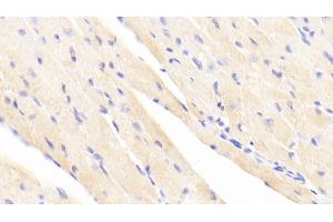 Detection of ACTN2 in Mouse Cardiac Muscle Tissue using Polyclonal Antibody to Actinin Alpha 2 (ACTN2) (ACTN2 抗体  (AA 1-254))