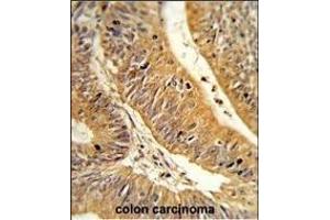 Immunohistochemistry (Paraffin-embedded Sections) (IHC (p)) image for anti-CXXC Finger Protein 4 (CXXC4) (AA 158-185), (C-Term) antibody (ABIN653333)