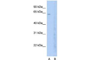 Host:  Rabbit  Target Name:  BRD7  Sample Type:  Jurkat  Lane A:  Primary Antibody  Lane B:  Primary Antibody + Blocking Peptide  Primary Antibody Concentration:  2. (BRD7 抗体  (C-Term))