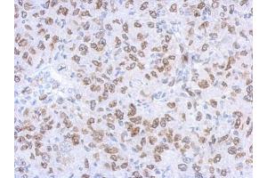 IHC-P Image Immunohistochemical analysis of paraffin-embedded Mahlarvu xenograft, using Lamin A + C, antibody at 1:500 dilution. (Lamin A/C 抗体)