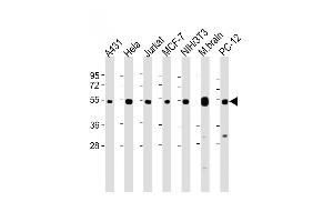 All lanes : Anti-TUBA4A Antibody (C-term) at 1:8000 dilution Lane 1: A431 whole cell lysate Lane 2: Hela whole cell lysate Lane 3: Jurkat whole cell lysate Lane 4: MCF-7 whole cell lysate Lane 5: NIH/3T3 whole cell lysate Lane 6: Mouse brain lysate Lane 7: PC-12 whole cell lysate Lysates/proteins at 20 μg per lane. (TUBA4A 抗体  (C-Term))