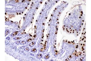 IHC analysis of MUC2 using anti-MUC2 antibody . (MUC2 抗体)