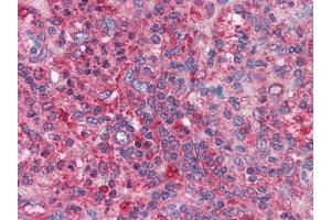 Human Spleen: Formalin-Fixed, Paraffin-Embedded (FFPE) (BIRC3 抗体)