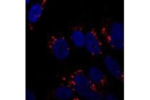 Immunofluorescent staining of ATG5 on SH-SY5Y cells using ATG5 polyclonal antibody  at 1 : 250. (ATG5 抗体  (AA 1-50))