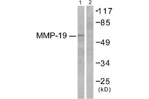 Western blot analysis of extracts from HuvEc cells, using MMP-19 antibody (ABIN2843550). (MMP19 抗体  (N-Term))