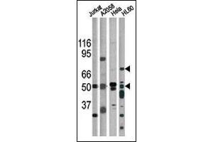 The anti-Phospho-CHK1- Pab (ABIN391324 and ABIN2841354) is used in Western blot for detection in, from left to right, Jurkat, , Hela, and HL60 tissue lysates. (CHEK1 抗体  (pSer317))