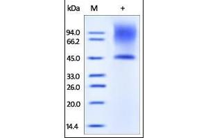 SDS-PAGE (SDS) image for Decorin (DCN) (AA 17-359) protein (His tag) (ABIN2180962)
