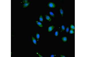 Immunofluorescence (IF) image for anti-Salvador Homolog 1 (SAV1) (AA 1-210) antibody (ABIN7166096)