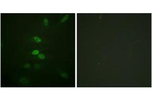 Immunofluorescence analysis of HeLa cells, using CDC25B (Ab-353) Antibody. (CDC25B 抗体  (AA 319-368))