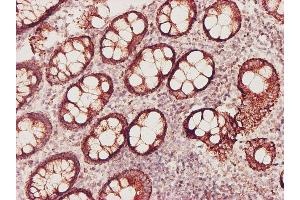 Immunoperoxidase of monoclonal antibody to GSS on formalin-fixed paraffin-embedded human colon tissue. (Glutathione Synthetase 抗体)
