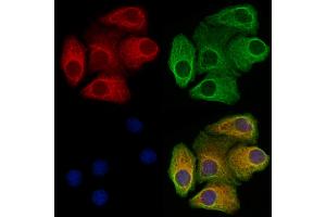 ABIN6265294 and ABIN6273324 staining Hela cells by IF/ICC.