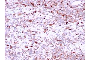 Immunohistochemistry (IHC) image for anti-Cathepsin K (CTSK) (AA 163-274) antibody (ABIN6939219)