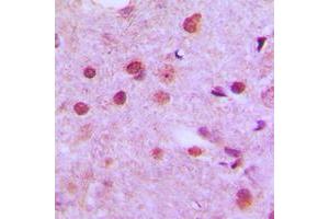 Immunohistochemical analysis of NFYC staining in human brain formalin fixed paraffin embedded tissue section.
