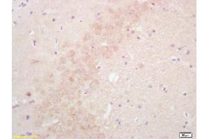 Formalin-fixed and paraffin embedded rat brain labeled with Rabbit Anti SULT1E1/Estrogen Sulfotranferase Polyclonal Antibody, Unconjugated (ABIN671106) at 1:200 followed by conjugation to the secondary antibody and DAB staining (SULT1E1 抗体  (AA 51-145))
