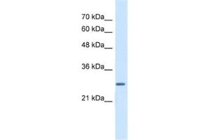 Western Blotting (WB) image for anti-Enoyl CoA Hydratase, Short Chain, 1, Mitochondrial (ECHS1) antibody (ABIN2462885) (ECHS1 抗体)