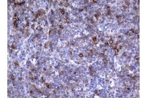 Image no. 1 for anti-Fc Fragment of IgE, Low Affinity II, Receptor For (CD23) (FCER2) (AA 48-321) antibody (ABIN1491553)