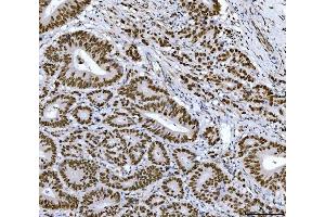 IHC analysis of RCC1 using anti-RCC1 antibody (ABIN7600022). (RCC1 抗体  (AA 14-421))