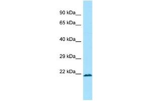 WB Suggested Anti-MRPL12 Antibody Titration: 1. (MRPL12 抗体  (Middle Region))