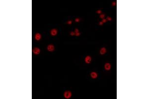 Immunofluorescence (fixed cells) (IF/ICC) image for anti-CCAAT/enhancer Binding Protein (C/EBP), epsilon (CEBPE) (Internal Region) antibody (ABIN6260350)