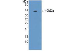 Western blot analysis of recombinant Mouse PLA2R1. (PLA2R1 抗体  (AA 1418-1487))