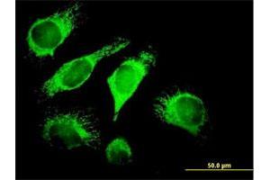 Immunofluorescence of purified MaxPab antibody to DNAJA3 on HeLa cell.