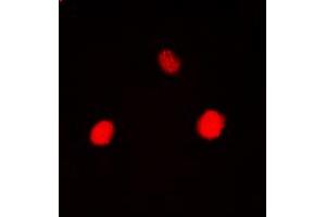 Immunofluorescent analysis of Hexokinase 1 staining in HEK293T cells. (Hexokinase 1 抗体  (N-Term))