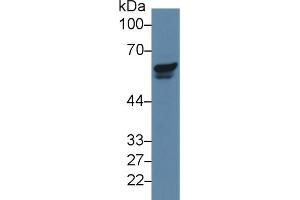 Western blot analysis of Human Jurkat cell lysate, using Human PAK2 Antibody (5 µg/ml) and HRP-conjugated Goat Anti-Rabbit antibody (