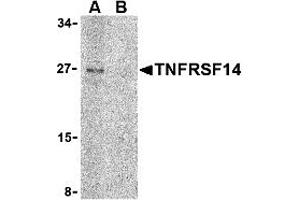 Western Blotting (WB) image for anti-Tumor Necrosis Factor Receptor Superfamily, Member 14 (TNFRSF14) (C-Term) antibody (ABIN1030760) (HVEM 抗体  (C-Term))