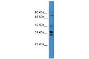 Image no. 1 for anti-GIPC PDZ Domain Containing Family, Member 3 (GIPC3) (AA 221-270) antibody (ABIN6745447) (GIPC3 抗体  (AA 221-270))