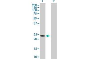 Western Blot analysis of RAB7B expression in transfected 293T cell line by RAB7B MaxPab polyclonal antibody. (RAB7B 抗体  (AA 1-199))