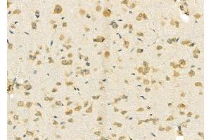 ABIN6257639 and ABIN6274782 at 1/100 staining Rat brain tissue by IHC-P. (RPL39 抗体  (C-Term))