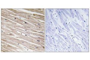 Immunohistochemistry (IHC) image for anti-phosphoprotein Enriched in Astrocytes 15 (PEA15) (pSer104) antibody (ABIN1847322) (PEA15 抗体  (pSer104))