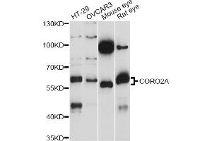 Western blot analysis of extracts of various cell lines, using CORO2A antibody (ABIN6293915) at 1:1000 dilution. (CORO2A 抗体)