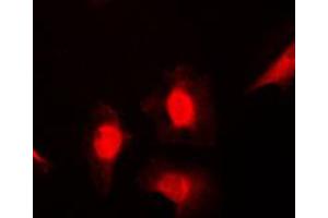 Immunofluorescent analysis of HSC70 staining in NIH3T3 cells. (Hsc70 抗体  (Center))
