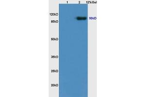SDS-PAGE (SDS) image for anti-Neurotrophic Tyrosine Kinase, Receptor, Type 2 (NTRK2) (AA 401-500) antibody (ABIN725870)