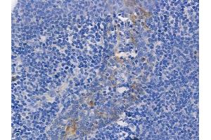 ABIN6255771 and ABIN6267262 at 1/100 staining human normal tonsil tissue by IHC-P. (EGFR 抗体  (pTyr1068, pTyr1092))