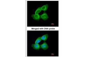 Immunofluorescence (IF) image for anti-Tubulin, alpha 1a (Tuba1a) antibody (ABIN2856707)