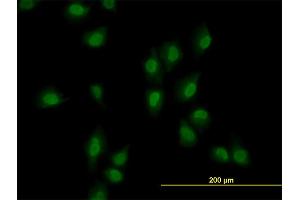 Immunofluorescence of monoclonal antibody to ARID1B on HeLa cell. (ARID1B 抗体  (AA 1364-1460))