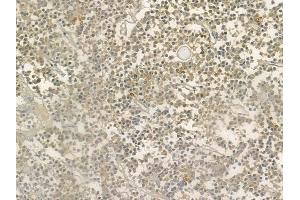 ABIN6264533 and ABIN6276573 at 1/100 staining human pituitary adenoma by IHC-P.