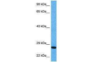 Host:  Mouse  Target Name:  BDNF  Sample Tissue:  Mouse Pancreas  Antibody Dilution:  1ug/ml (BDNF 抗体  (Middle Region))
