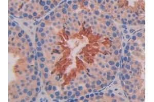 Detection of IL11Ra in Mouse Testis Tissue using Polyclonal Antibody to Interleukin 11 Receptor Alpha (IL11Ra)